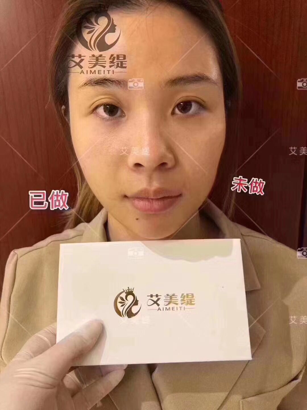 艾美缇使用方法